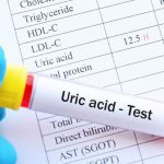 Acid uric cao