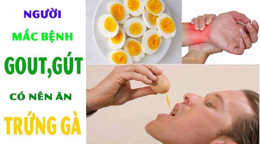 Bệnh Gout có được ăn trứng không