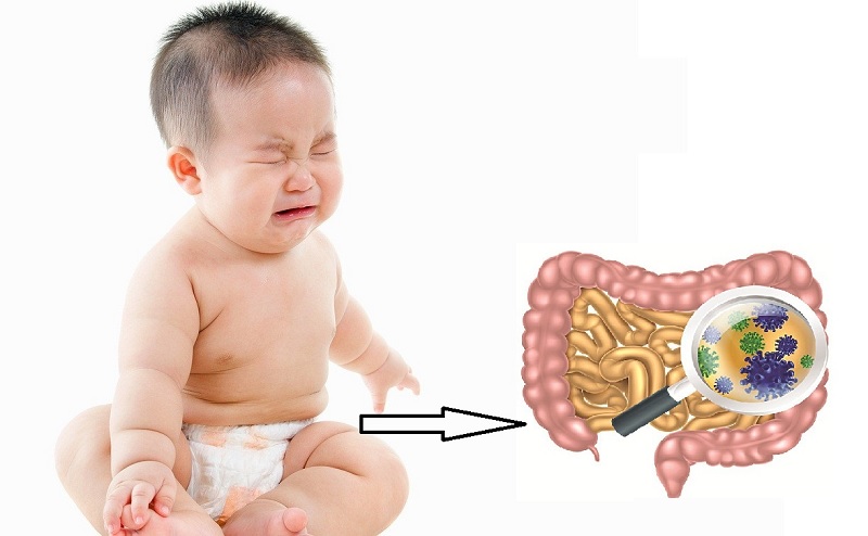 Nhiễm trùng đường ruột ở trẻ em