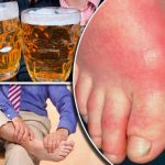 bệnh gout có uống được bia, rượu