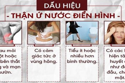 Triệu chứng thận ứ nước