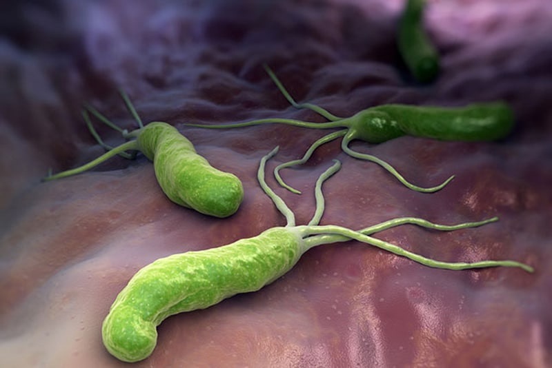 Vi khuẩn Hp là gì