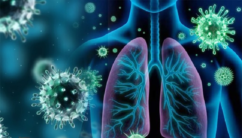 Nguyên nhân của bệnh viêm phế quản phổi