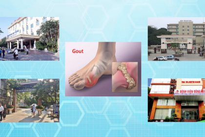 khám chữa bệnh gout ở đâu tại Hà Nội