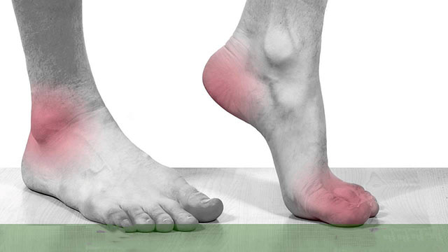 Bệnh gout thường xuất hiện ở đâu