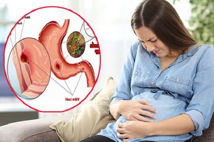 Đau dạ dày khi mang thai 3 tháng cuối