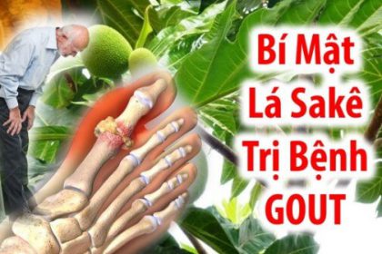 Chữa Bệnh gout bằng lá sa ke