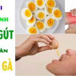 Bệnh Gout có được ăn trứng không